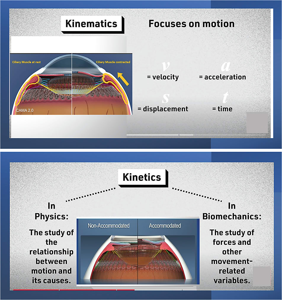 Figure 3. Kinematics and kinetics in accommodation. Diagrams are from 28.