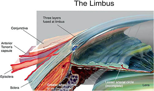 Figure 2. Anatomy of the anterior eye near the limbus. (Reprinted from Hughes MO, Luce CA. Depicting the Anterior Eye in Two and Three Dimensions. Part Two: Iris, Limbus and Sclera. Journal of Biocommunication: 2005;31:2).