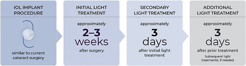 Figure 4. Timing of surgery and light treatment schedule.IMAGE PROVIDED BY RXSIGHT AND USED WITH PERMISSION.