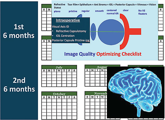 Figure 5. Setting your and your team&amp;#x2019;s, along with the patient&amp;#x2019;s, expectations for what happens during the first and second 6 months of the 1-year journey makes for the happiest multifocal patients.