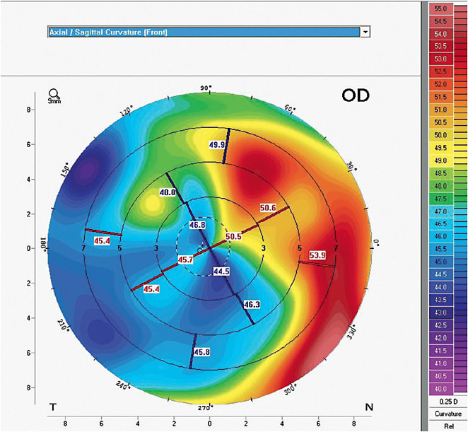 Figure 3. Topography display showing a steep-to-flat pattern.