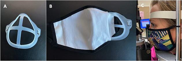Figure 5. Silicone bracket for face mask rigidity (A). Silicone face mask bracket partially inserted into cloth face mask (B). Cloth face mask with silicone bracket positioned at the slit lamp (C).