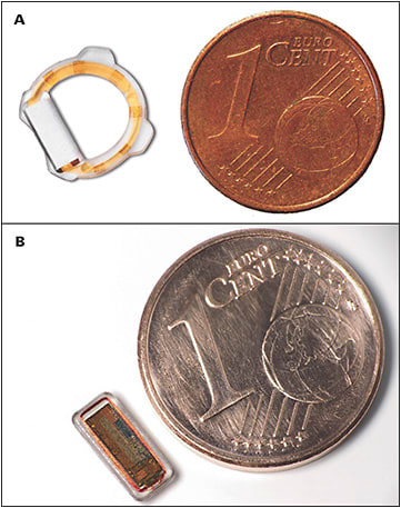 Figure 2. Eyemate-IO (A) and Eyemate-SC (B) shown in relation to a 1-cent Euro coin. Images courtesy of Implandata Ophthalmic Products.