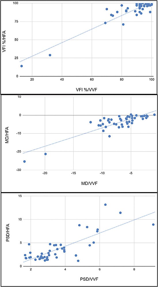 Figure 3. In a comparison of the Virtual Field (VVF; Virtual Field Inc.) against Humphrey field analyzer (Carl Zeiss Meditec Inc.), Pearson’s correlation coefficient for virtual field index, mean deviation, and pattern deviation were 0.93 (P<.00001), 0.85 (P<.00001) and 0.79 (P<.00001), respectively. Interclass correlation coefficient for virtual field index was 0.99, mean deviation was 0.74, and pattern deviation was 0.81.2