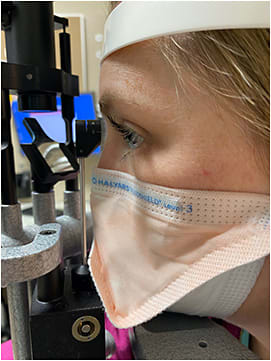 Figure 3. Halyard Fluidshield Surgical N95 Respirator Mask positioned at the slit lamp.
