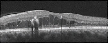 Figure 1
Images courtesy of Shannon Leon, OD, Joseph J. Pizzimenti, OD, Kirsti Ramirez, OD, and Carolyn Majcher, OD