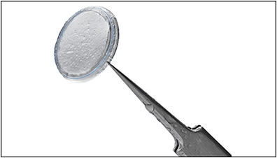 Figure 2. Prokera amniotic membrane tissue (Bio-Tissue).