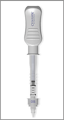 The SCS Microinjector.Image courtesy of Bausch + Lomb