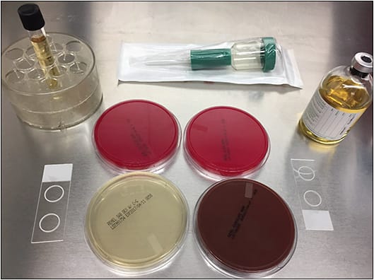 Figure 1. Various culture media used for vitreous sample in patients with endophthalmitis. IMAGE COURTESY OF HARRY FLYNN JR., MD