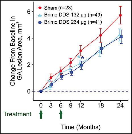 Figure 1.  Brimo DDS reduces GA progression rate at month 12 in patients with baseline lesion area ≥6 mm2. Effects were observed with both doses (light and dark blue) and they were statistically significant at month 12. Analysis was conducted using a mixed effects model with an unstructured covariance matrix.