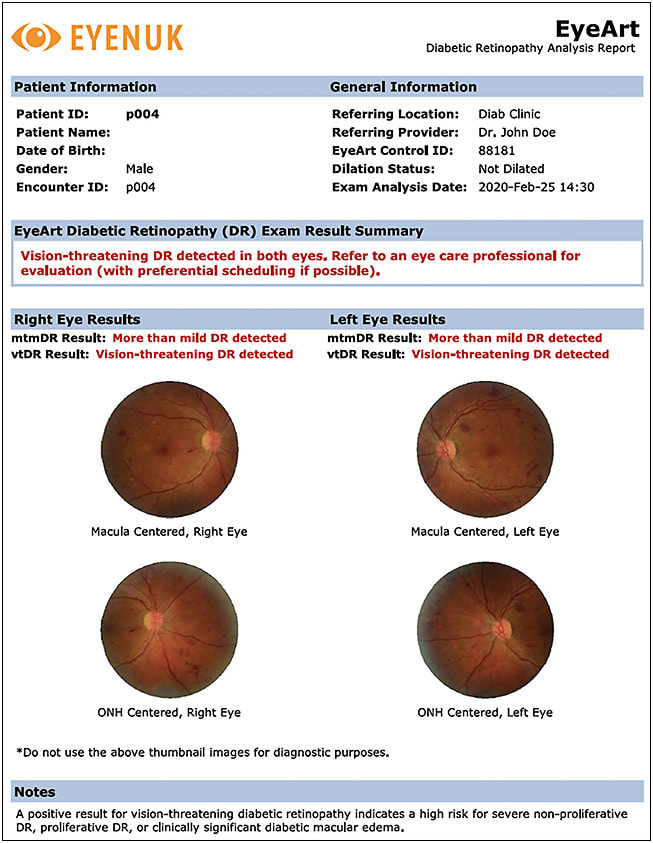 Figure 2. Eyenuk’s EyeArt report for a fictional patient showing diabetic retinopathy status (more than mild and vision-threatening diabetic retinopathy). Image courtesy of Eyenuk.
