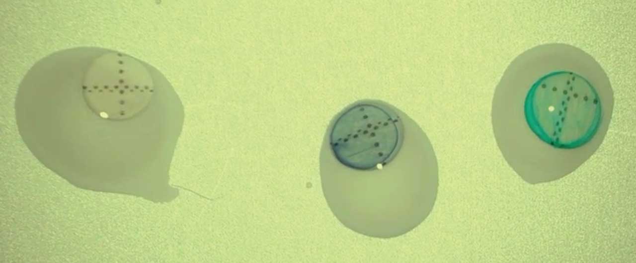 Figure 2. Staining the amniotic membrane with brilliant blue or trypan blue helps to improve intraoperative visualization of the graft.