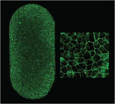 Figure 2. A patch made from patient-derived induced pluripotent stem cells (iPS) (left). Each patch (2 mm x 4 mm) contains approximately 75,000 retinal pigment epithelial RPE cells. Patch cells at higher magnification (right). Image by Kapil Bharti, PhD, National Eye Institute