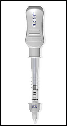 The SCS Microinjector.Image courtesy of Bausch &amp;#x2B; Lomb