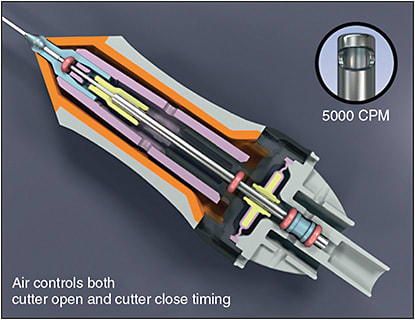 Figure 4. Dual-actuation cutters. These probes use separate air lines to both open and close the vitrectomy port. Image courtesy of Alcon.