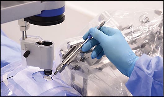 Figure 2. The co-manipulated robotic system developed by Mynutia and used to demonstrate retinal vein cannulation on human patients. Image courtesy KU Leuven