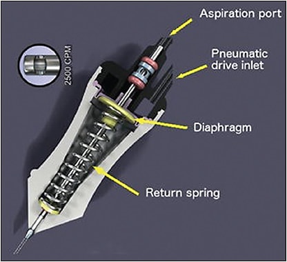 Figure 3. Single-actuation cutters. An air pulse pushes down the diaphragm inside the vitrectomy probe, which closes the port (the guillotine movement); at the same time, a spring is compressed and forces the diaphragm back to the open port position. Image courtesy of Alcon.