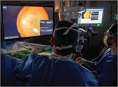 Figure 1. 3D digital system with intraoperative OCT integration (Artevo; Zeiss) enabling simultaneous surgical field and OCT datastream visualization.