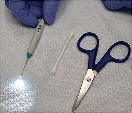 Figure 1. Materials needed for modified illuminated scleral depressor: scissors, sterile cotton swab with a hollow plastic shaft, and light pipe.