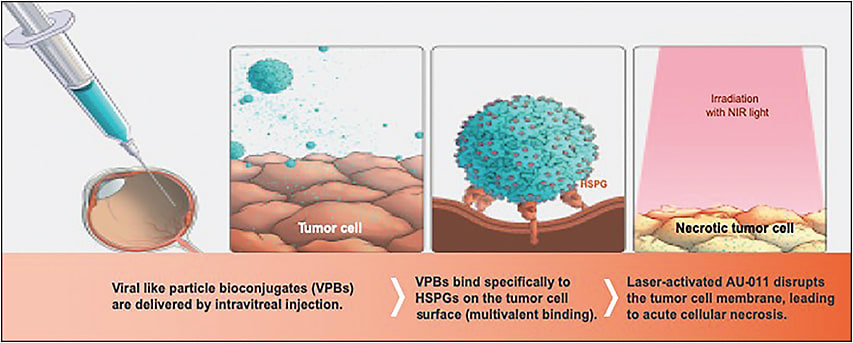 Figure 2. AU-011 mechanism of action: acute tumor cellular necrosis upon light activation.
IMAGE COURTESY OF AURA BIOSCIENCES