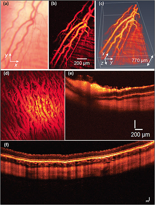 Figure 3. Photoacoustic microscopy of retinal and choroidal blood vessels in living rabbits: color fundus photography (A), corresponding PAM of retinal blood vessels (B), 3D volumetric visualization of PA signal (C), maximum intensity projection of PAM images of choroidal vessels (D), B-scan OCT images of retinal and choroidal blood vessels (E, F).1