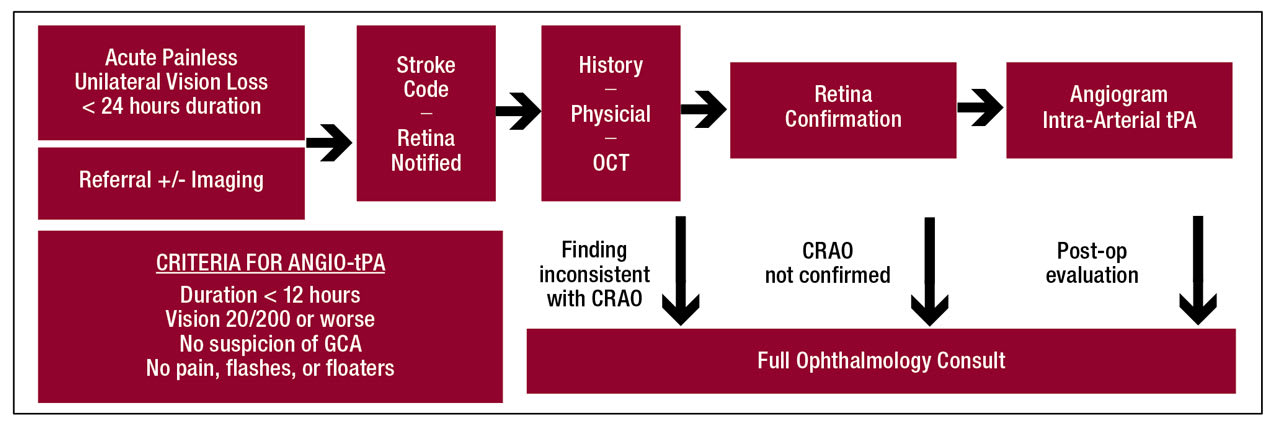 <p><strong>Figure 1.</strong> Algorithm for remote retinal artery occlusion diagnosis and criteria for angiogram and intra-arterial tissue plasminogen activator treatment in patients presenting with acute painless unilateral vision loss for less than 24 hours. ANGIO-tPA = angiogram and intra-arterial tissue plasminogen activator; CRAO = central retinal artery occlusion; GCA = giant cell arteritis.<span class="Apple-converted-space">&nbsp;</span></p>