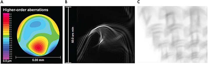 Figure 3. (A) Data from wavefront aberration maps can be used to calculate (B) point spread function (PSF), which can be further processed to create (C) a simulated retinal image of a visual acuity chart. These images are from a patient who has keratoconus and significantly elevated levels of vertical coma.9