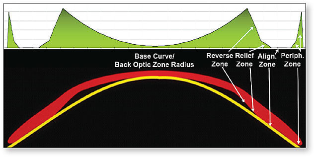 Figure 1. Tear profile (top) and profile view (bottom) of a reverse geometry ortho-k lens.