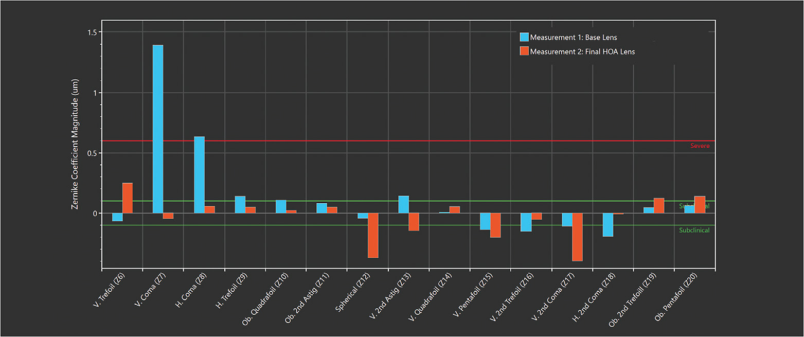 Figure 4. Plot of Zernike polynomial magnitudes through the baseline scleral lens correcting the lower-order aberrations (LOAs) (blue bars) and through the HOA-corrected scleral lens (red bars).
