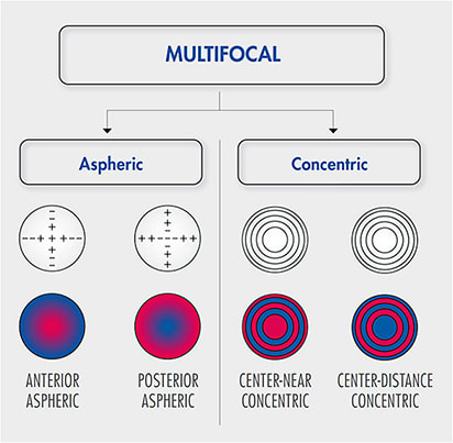 Figure 1. Examples of concentric and aspheric MFCL designs. The red indicates areas for near vision; the blue indicates areas for distance vision (based on Remón and coworkers11).