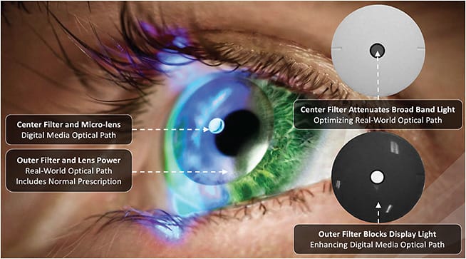 Figure 4. An augmented reality contact lens on eye.Image courtesy of Innovega Inc.