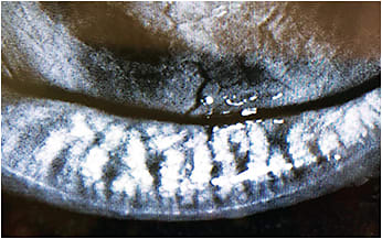 Figure 2. Infrared photography allows for high-definition imaging of the tear film lipid layer and the meibomian glands. Careful evaluation and management of the tear layer is essential for ocular health and comfort in contact lens patients.