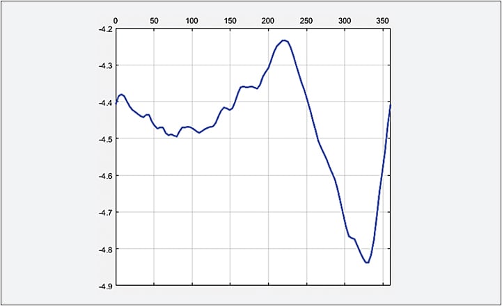 Figure 1. Sagittal plot of the patient’s left eye three months post-CXL.