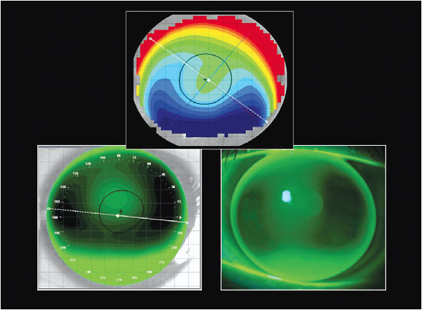 Figure 4. The elevation display map, the simulated fluorescein pattern, and the actual fluorescein pattern.