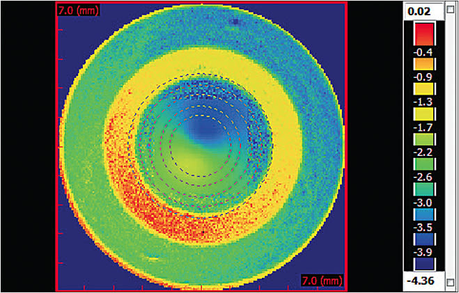 Figure 6. A multifocal lens used outside of the United States for myopia control. Note the concentric ring design compared to the gradual power change of the aspheric design in Figure 1.