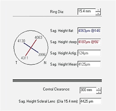 Figure 6. Data provided by scleral map for lens fitting. In this case, the ring diameter has been set to 15.4mm to fit a 15.4mm lens. At this diameter, the ideal lens should have a sagittal height of 4,425 microns and 124 microns of landing zone toricity.