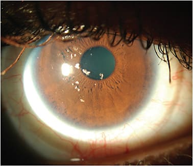 Figure 2. Lens calculi.Image courtesy of Graeme Young