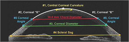 Figure 1. The five anatomical features that contribute to the sagittal height of the anterior eye.