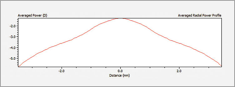 Figure 3. This center-near lens exhibits a power of approximately –1.00D in the center of the lens. There is a gradual slope toward more minus in the periphery of the lens, achieving its full labeled –3.00D at about 1.5mm from the center of the lens. Therefore, at a 3mm pupil diameter, the patient would be experiencing the full minus as well as an approximate +2.00D add. Note that further out into the lens periphery, the minus power continues to increase well past the labeled –3.00D power.