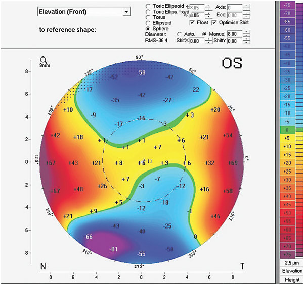 Figure 3. Elevation map.