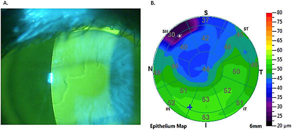 Figure 1a