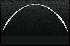 Figure 2. OCT example of an 8.8mm base curve, 14.4mm diameter commercially available soft toric contact lens, imaged along the indicator meridian (top) &amp; axis meridian (bottom).