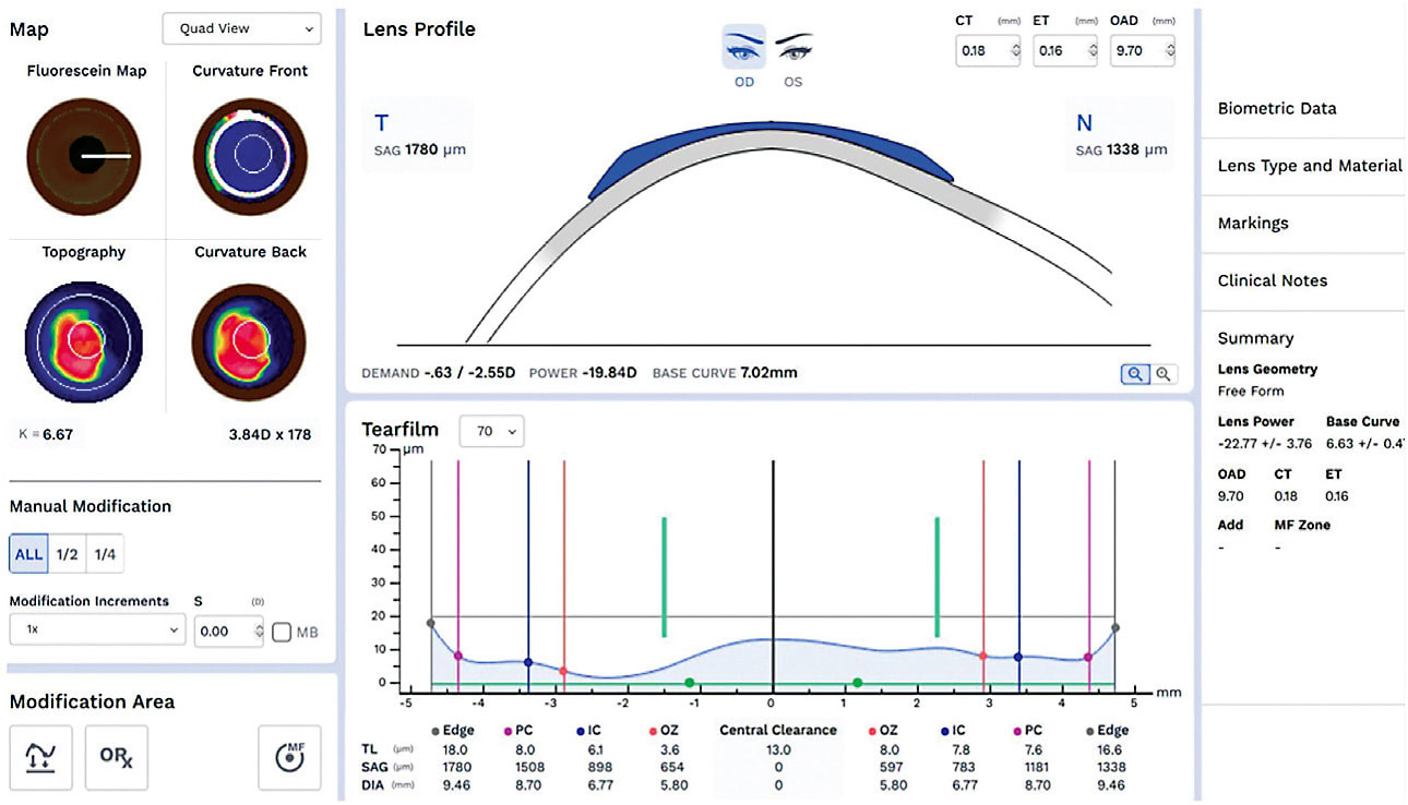 FIGURE 11. Image of digital software based on profilometry used to design a corneal GP. Photo courtesy of Sheila Morrison, OD