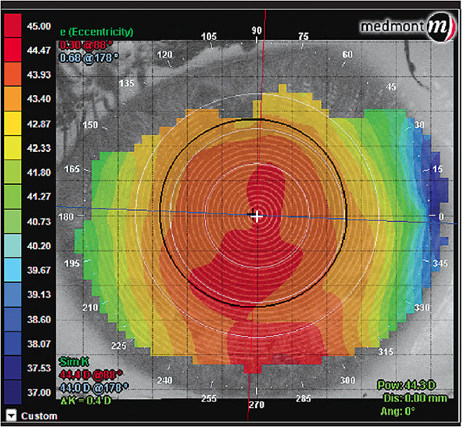 Figure 4. Axial map showing curvature with steep (red) and flat (blue) axes.