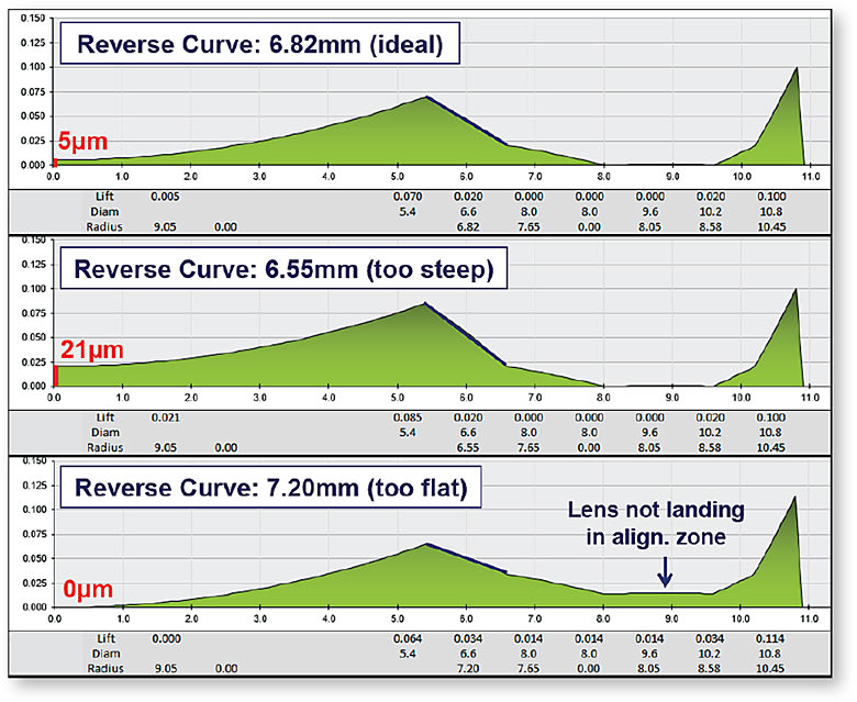 Figure 3. Three lenses with different reverse curve values; all other parameters are the same. The proper curvature creates ideal apical clearance (top); too steep causes excessive apical clearance (middle); and too flat causes apical bearing, preventing lens landing in the alignment zone (bottom).