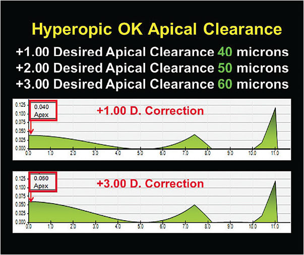 Figure 3. The base curve apical clearances required to create +1.00D, +2.00D, and +3.00D corrections.