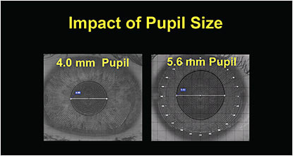 Figure 4. Pupil size as measured by corneal topography.