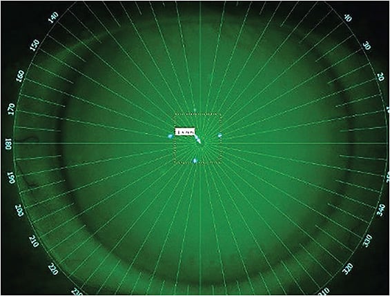 Figure 8. Many topographers employ reticules that may be used to evaluate the angles of rotation in toric lenses.