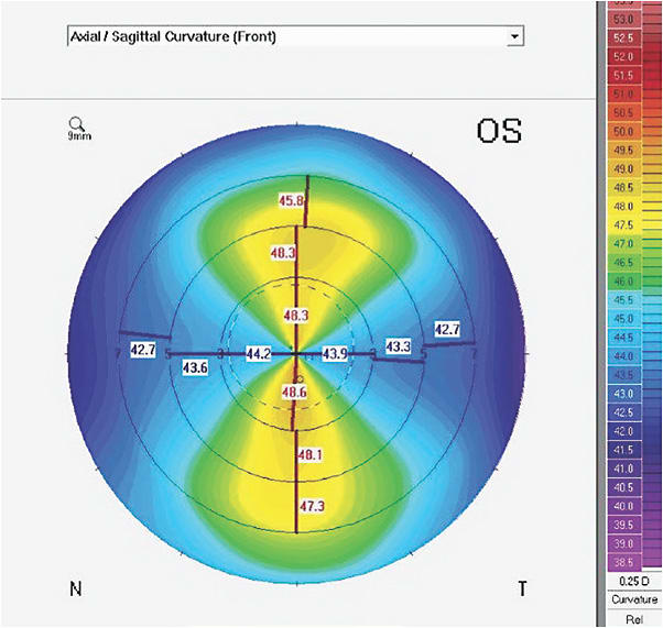 Figure 1. Axial map.