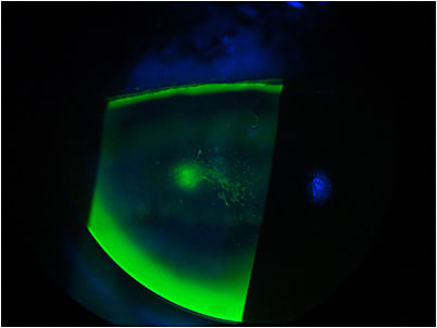 Figure 2. Close look at the fluorescein staining OD.